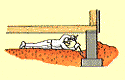 Treatment Illustration 2
